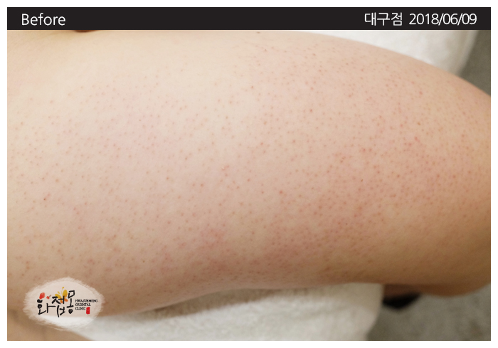 전후사진