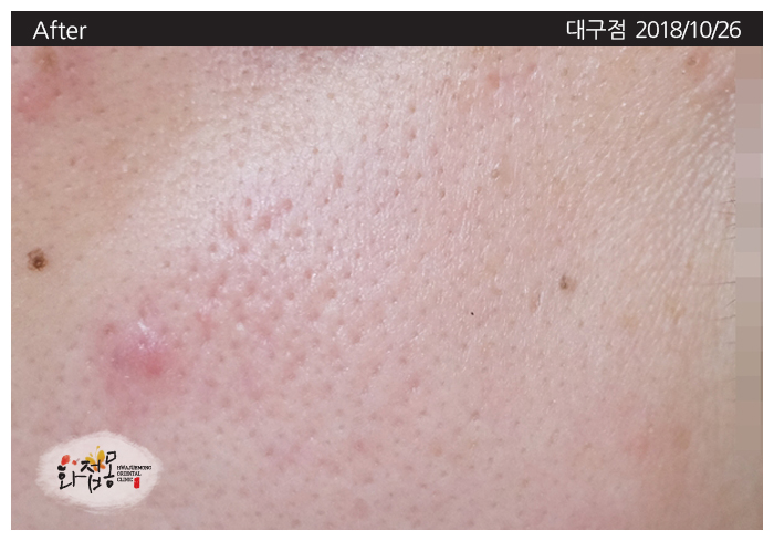전후사진