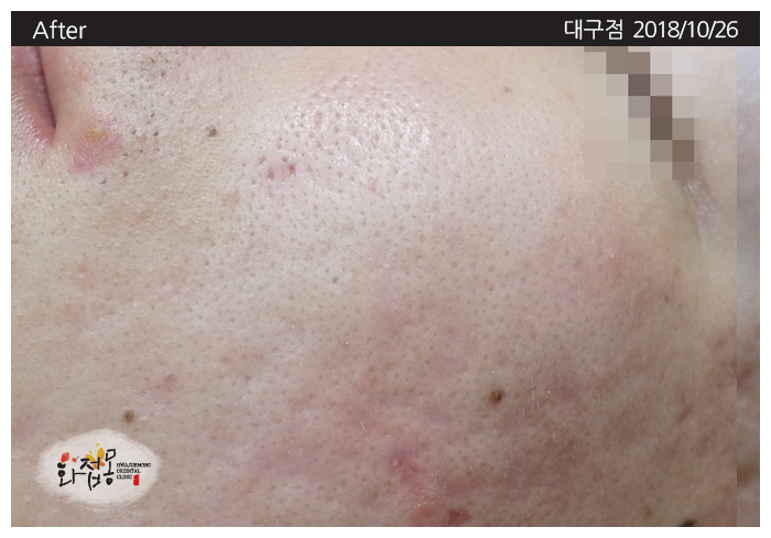 전후사진