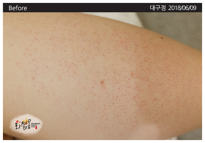 전후사진