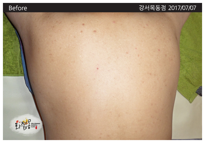 전후사진