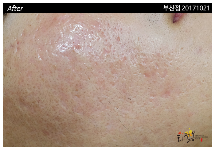 전후사진