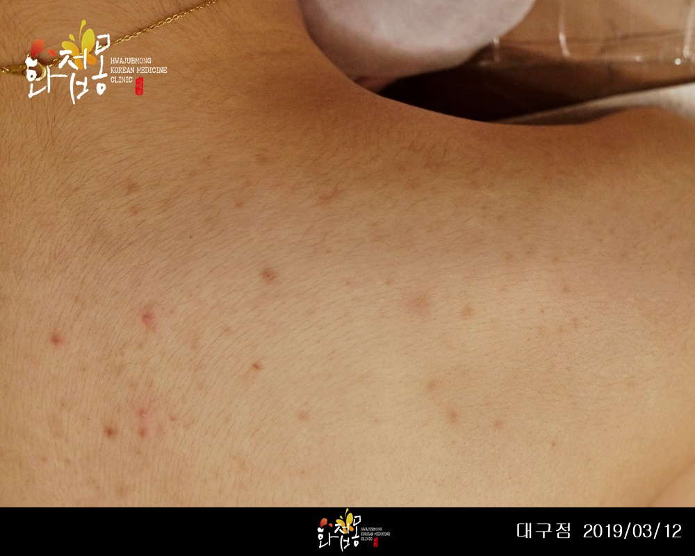 전후사진