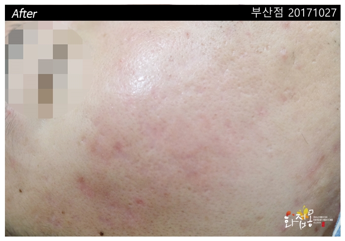 전후사진
