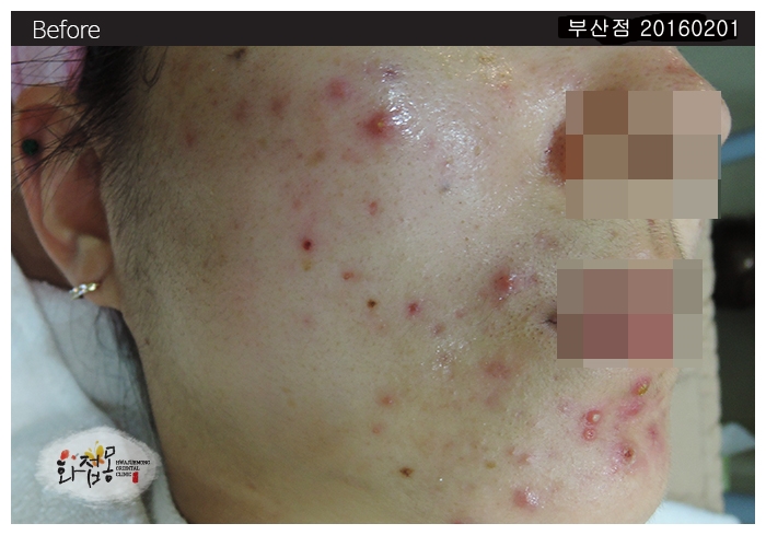 전후사진