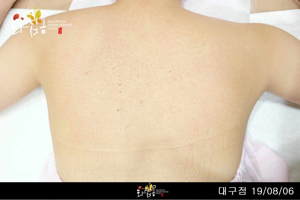 전후사진