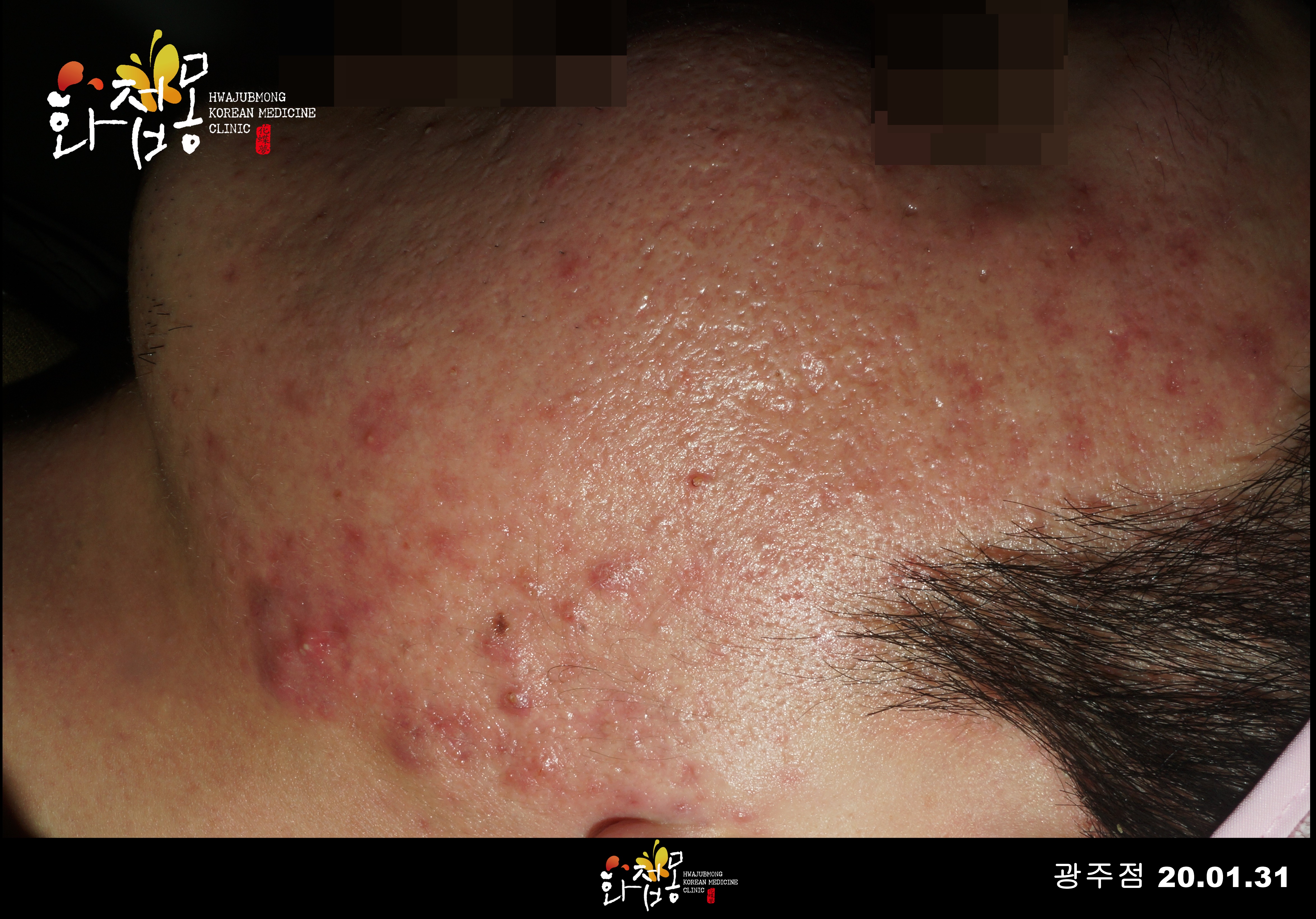 전후사진