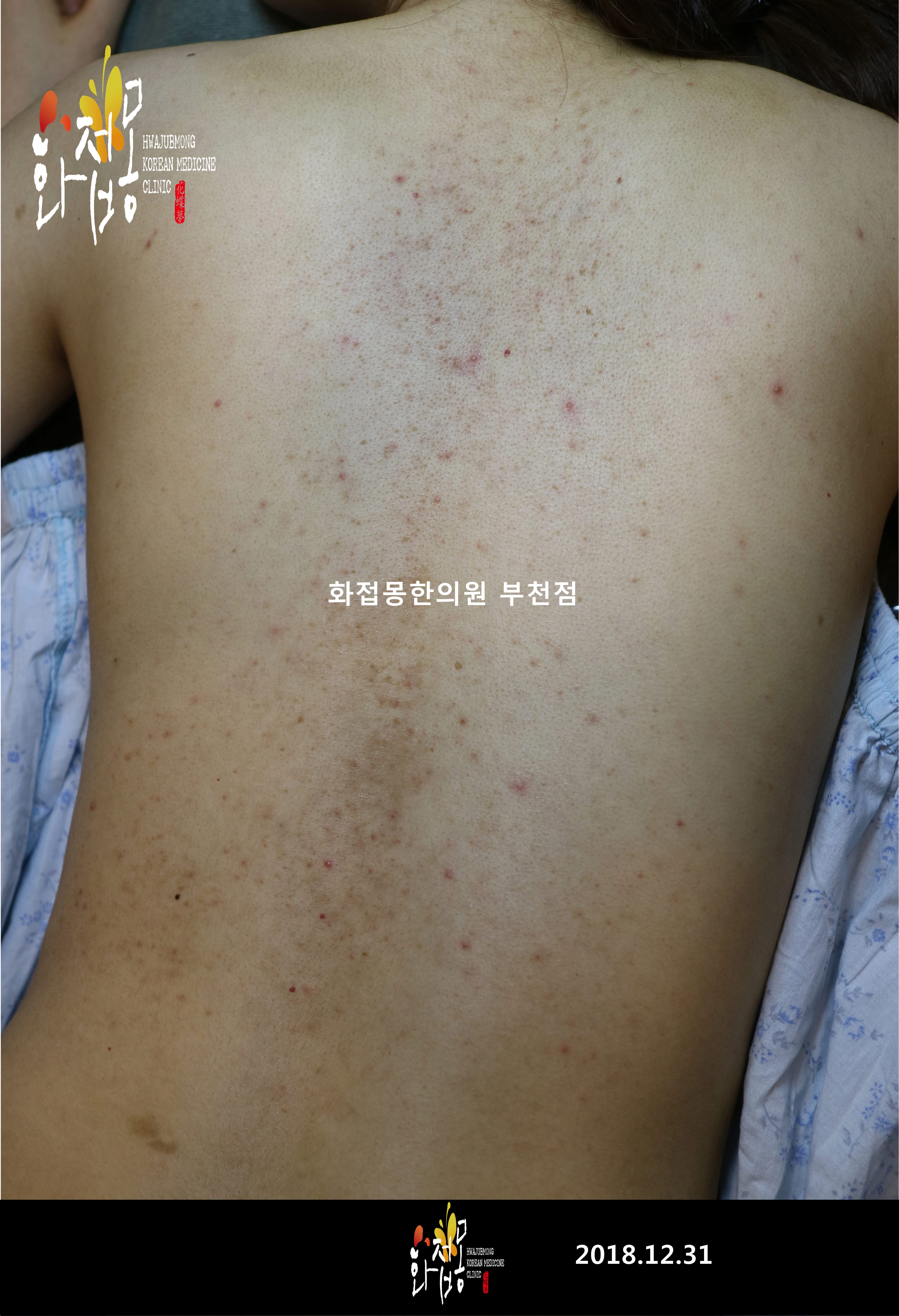 전후사진