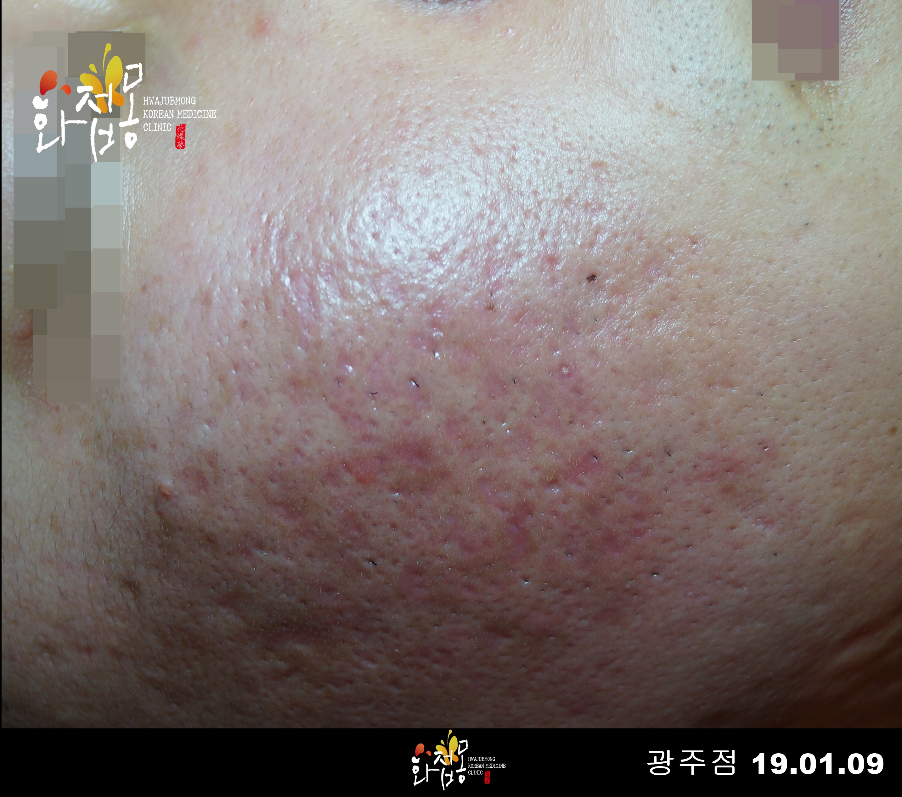 전후사진
