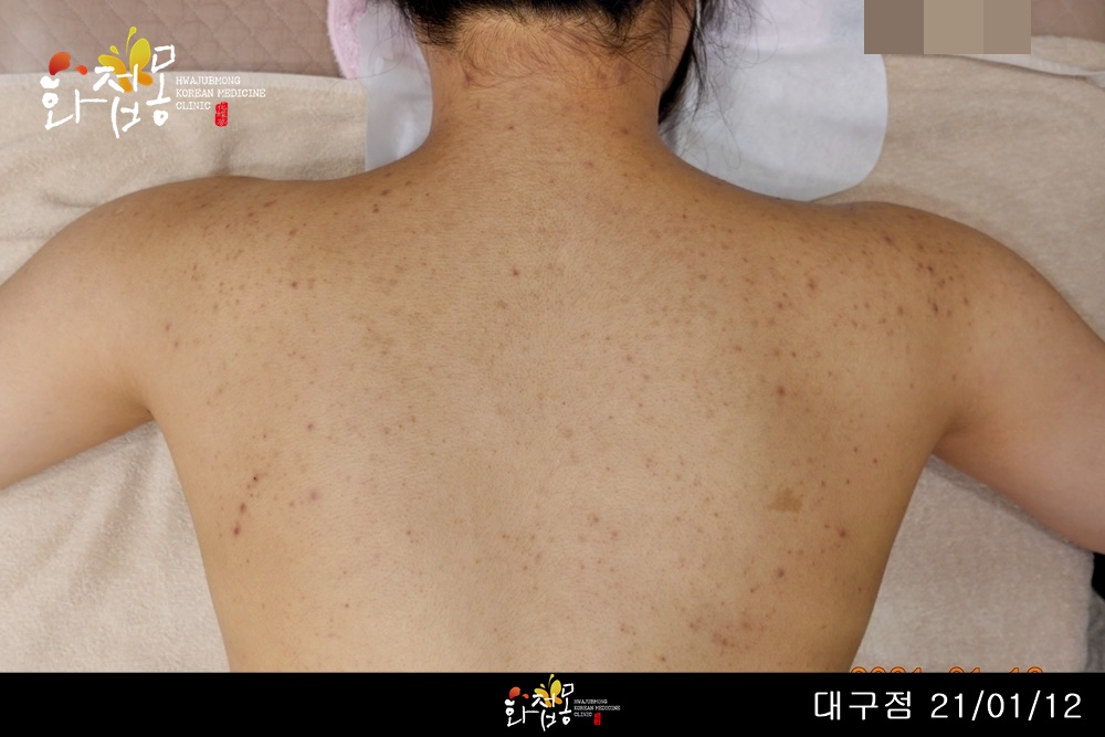 전후사진