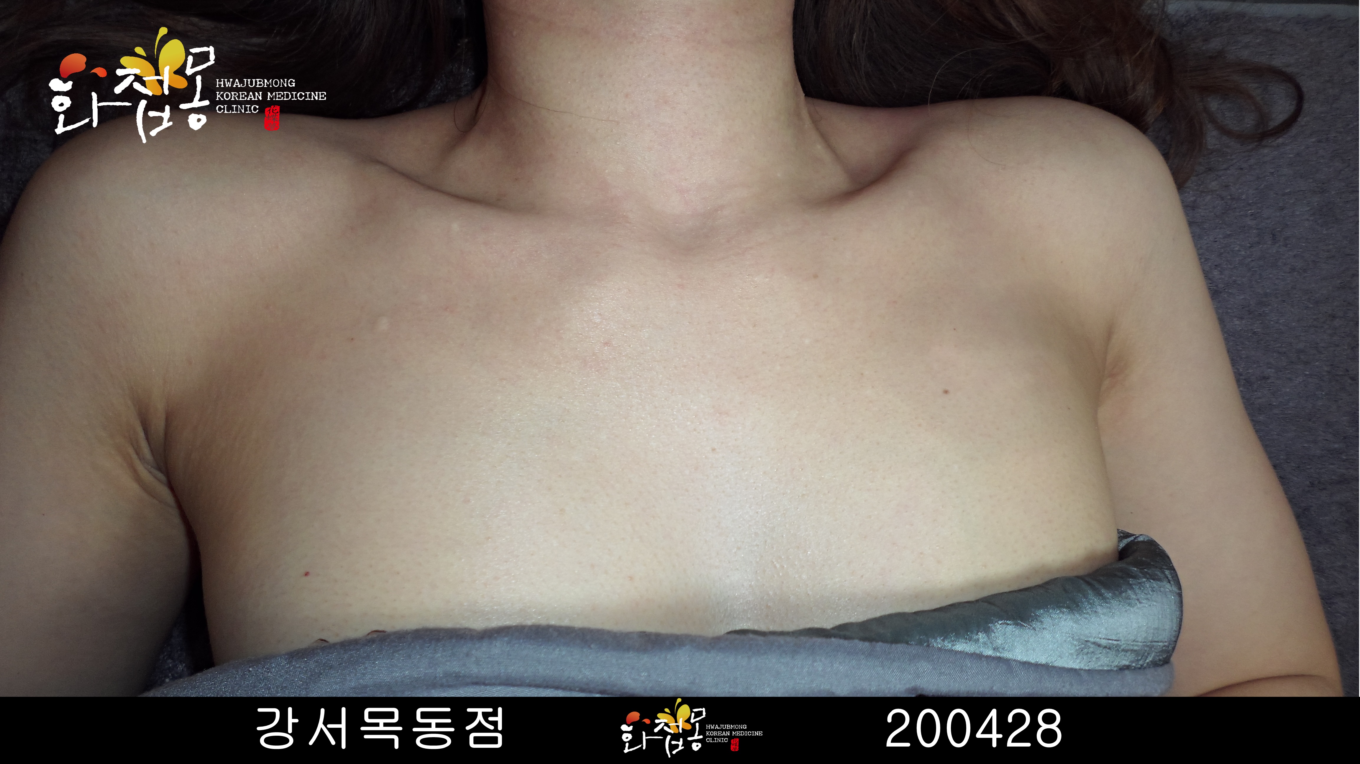 전후사진