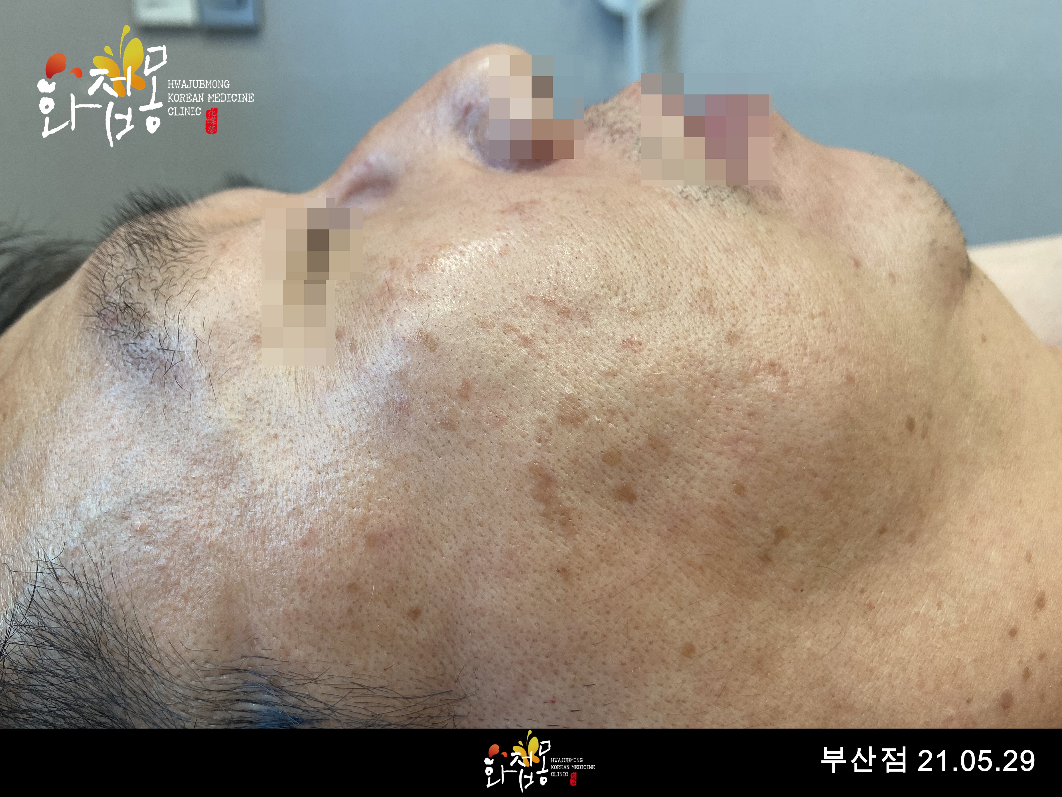 전후사진
