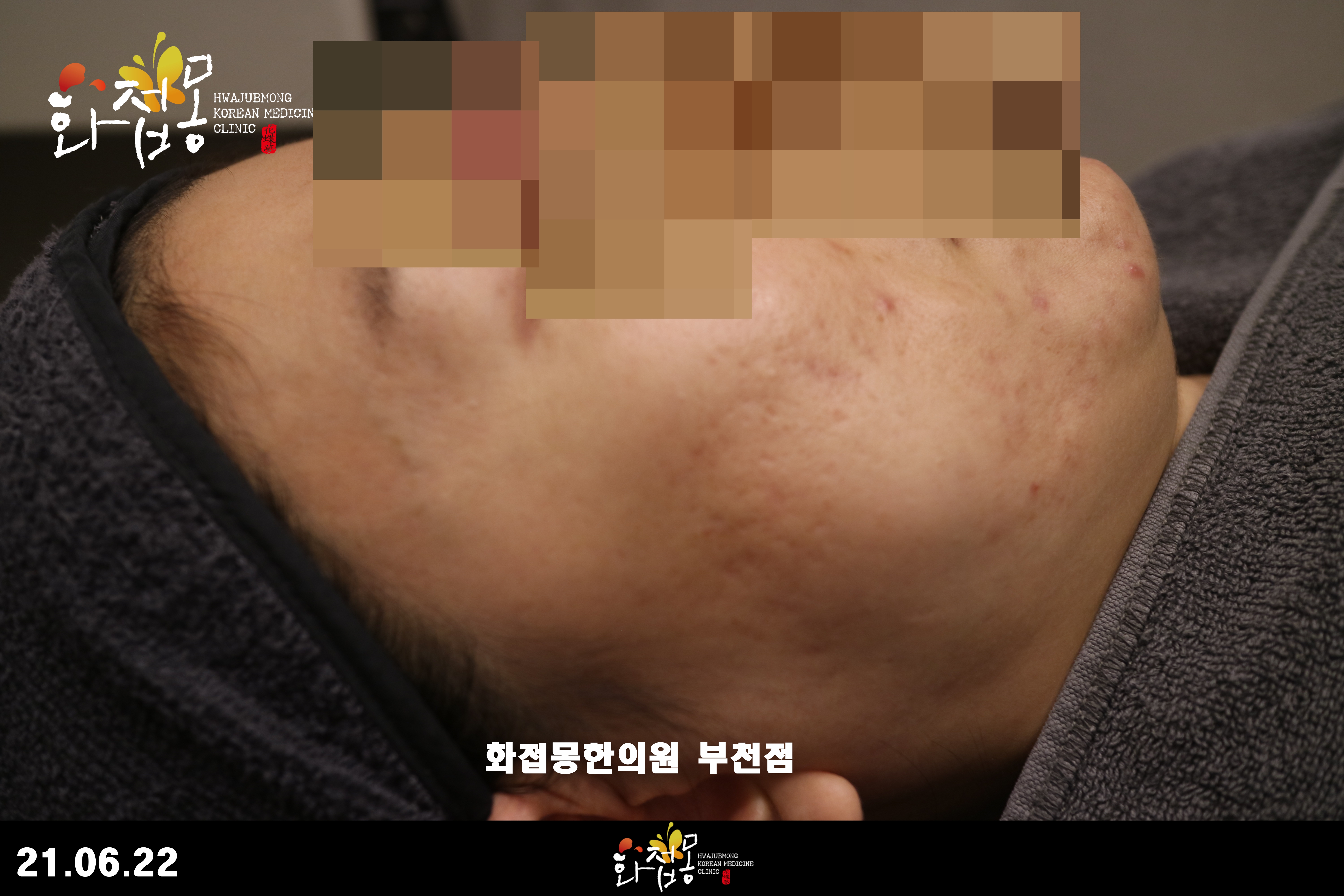 전후사진