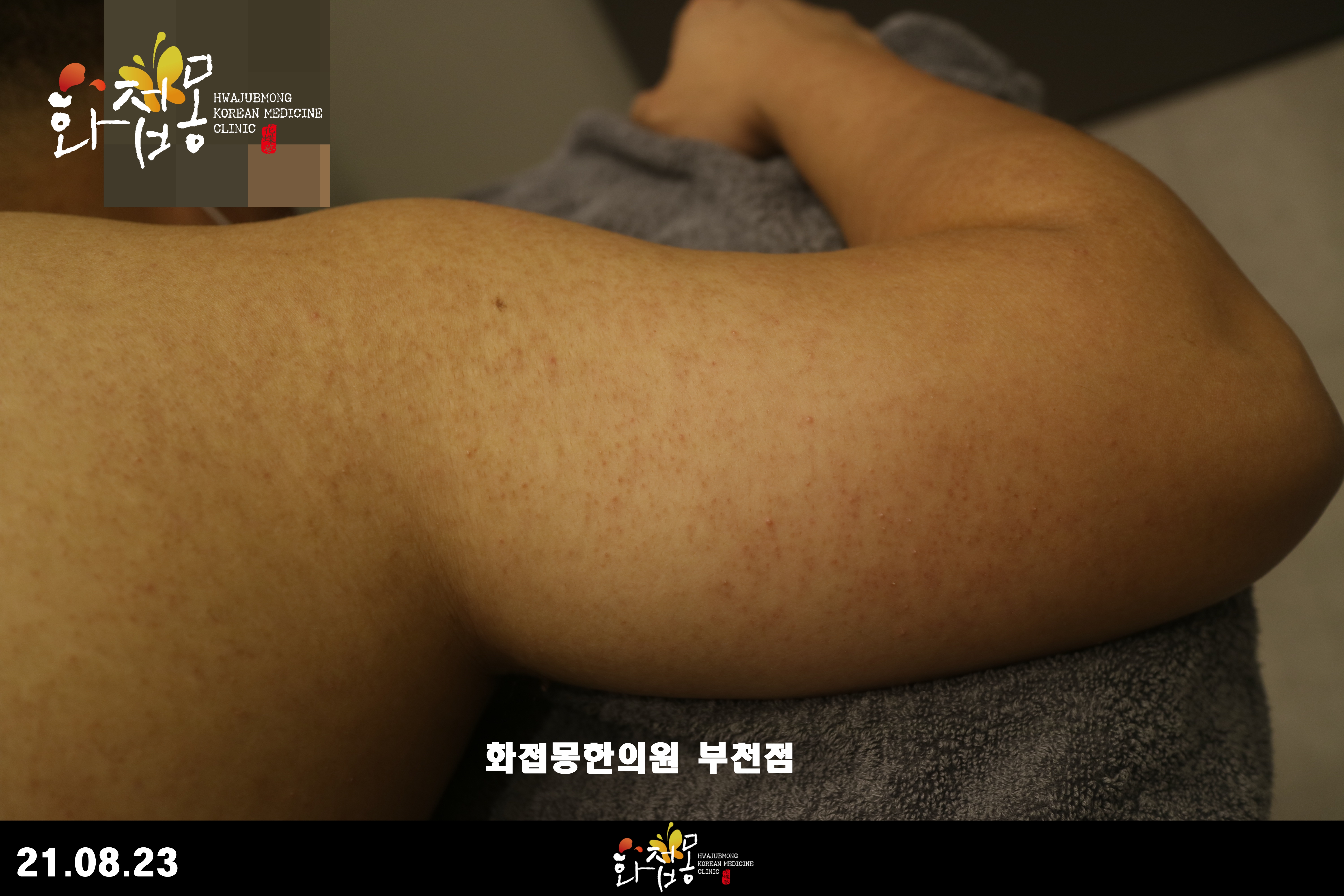 전후사진