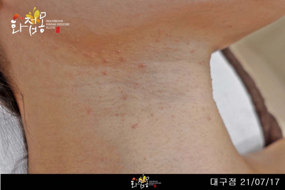 전후사진