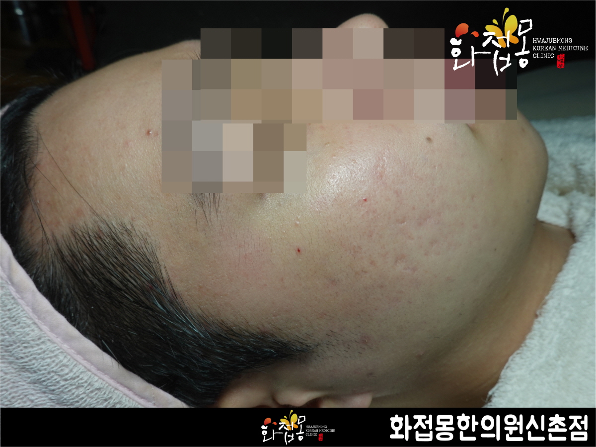 전후사진
