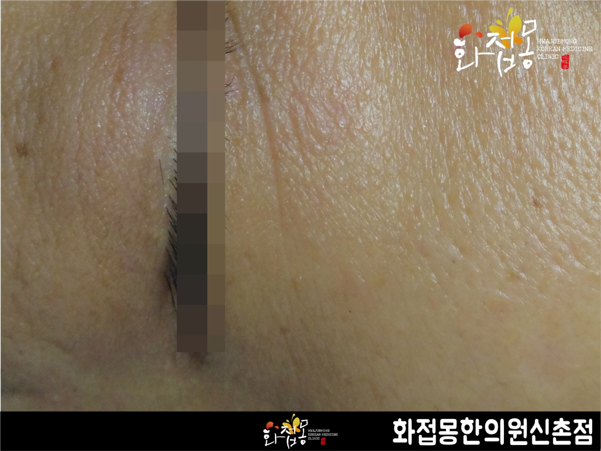 전후사진