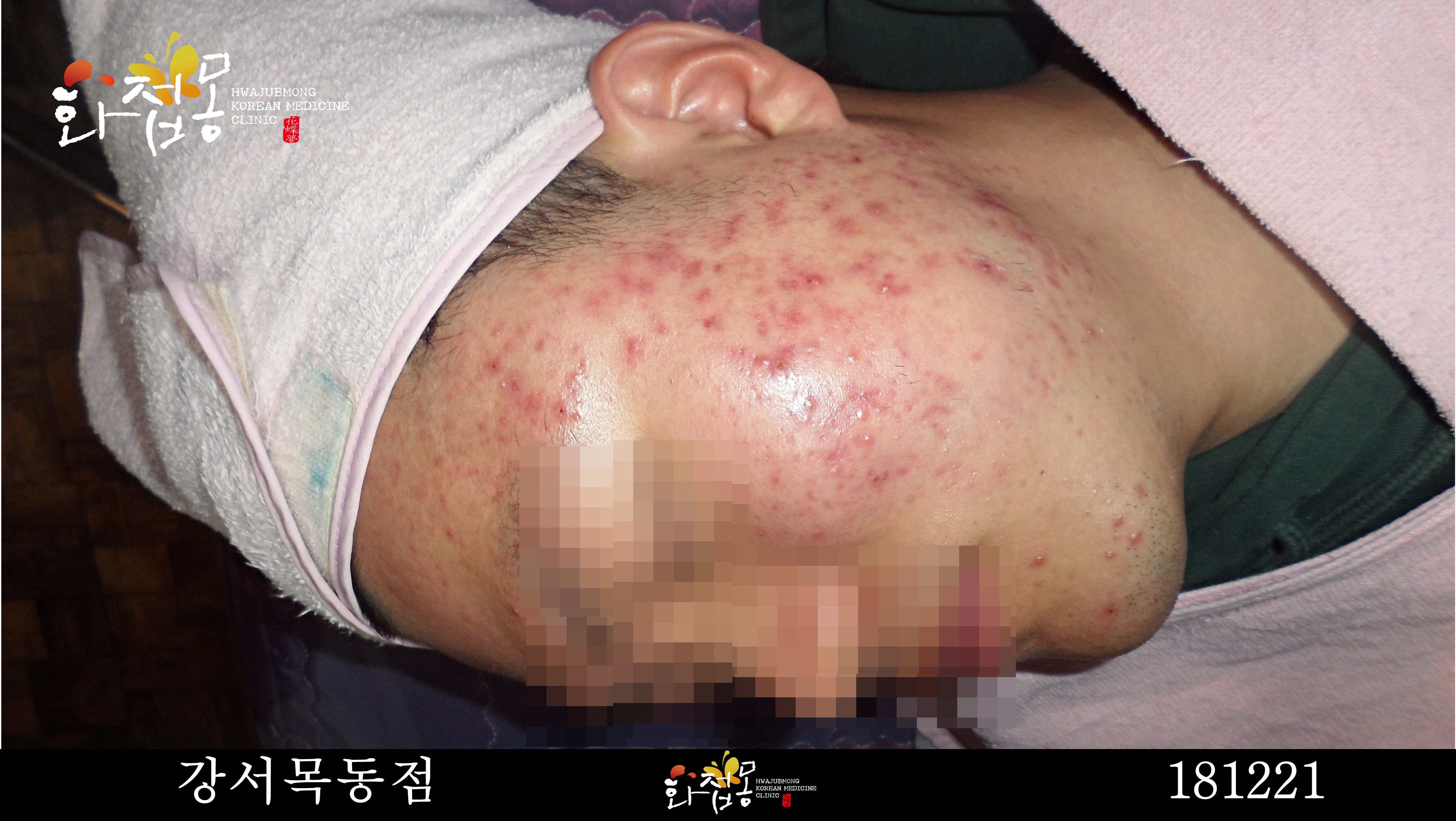 전후사진