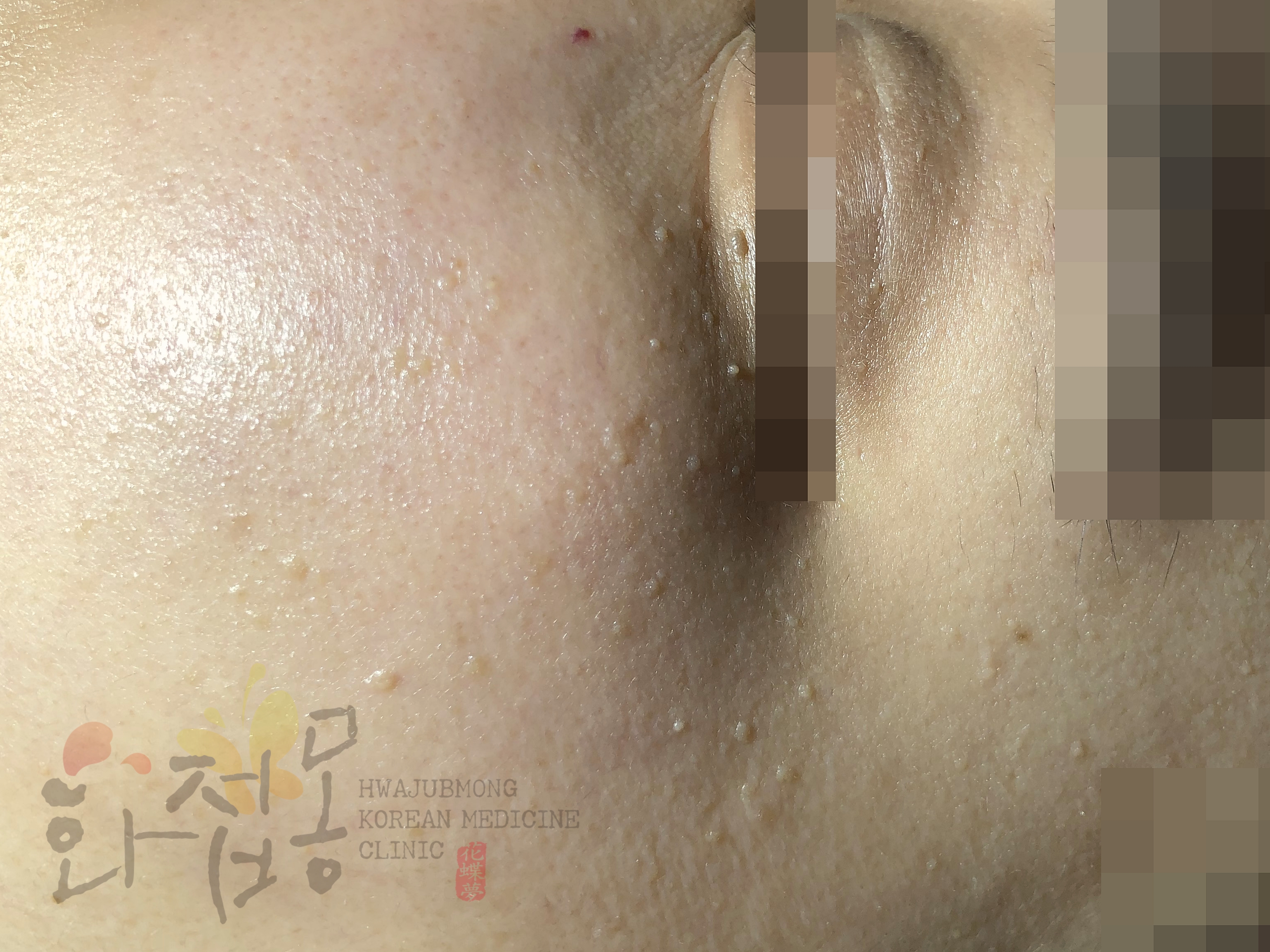 전후사진