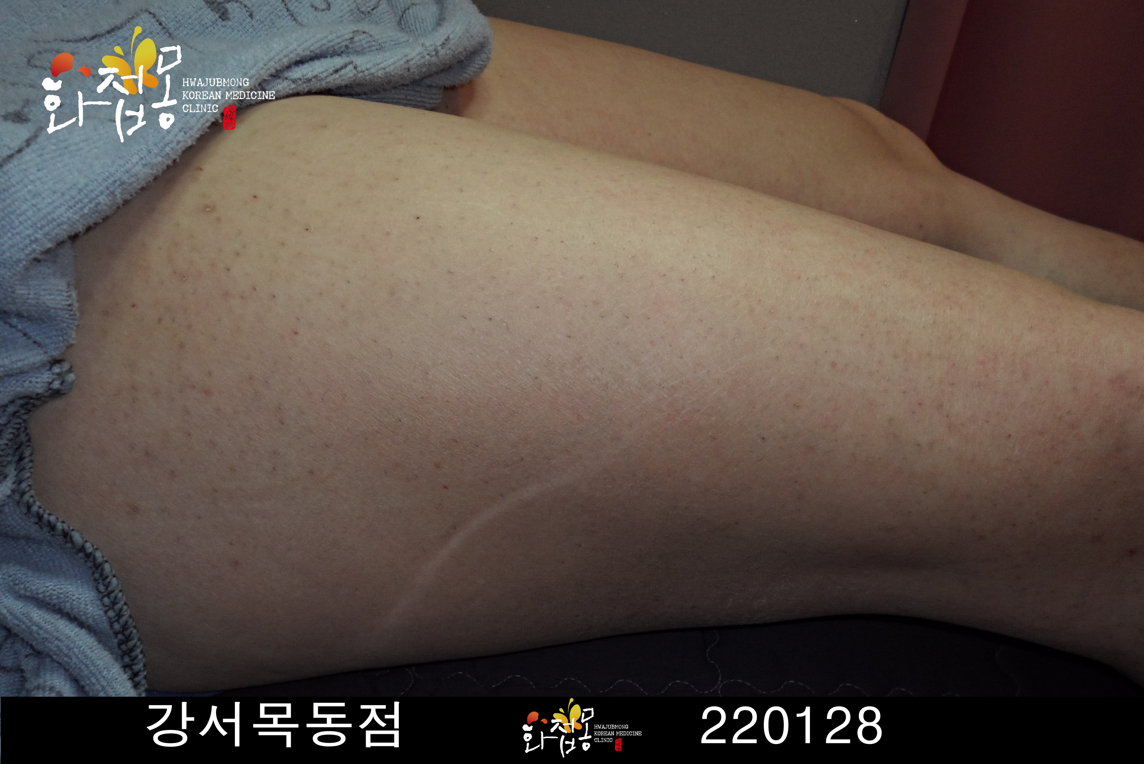 전후사진