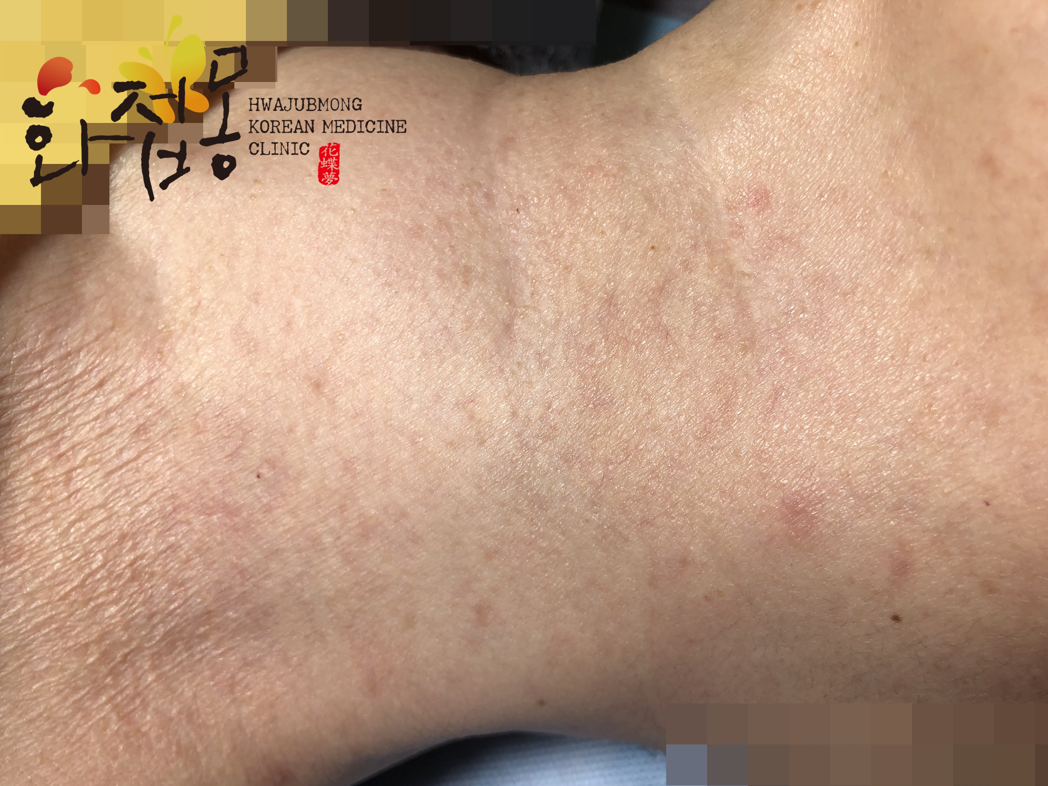 전후사진