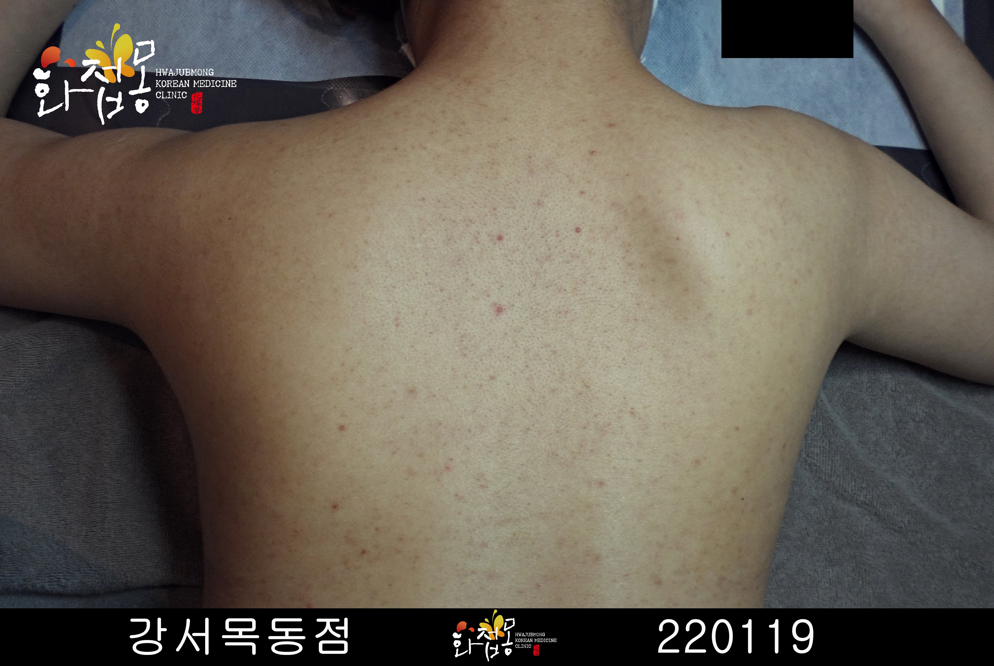 전후사진