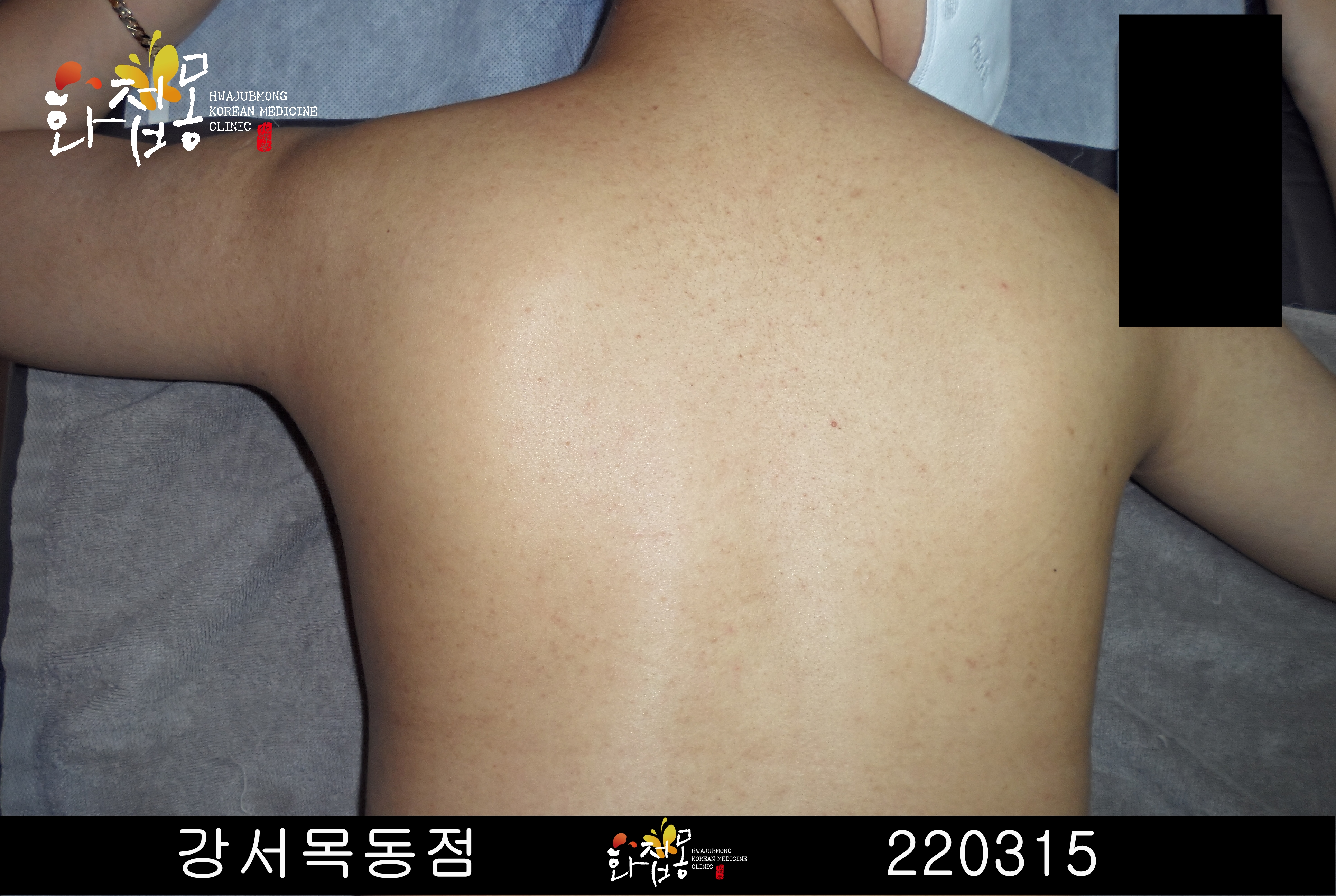 전후사진