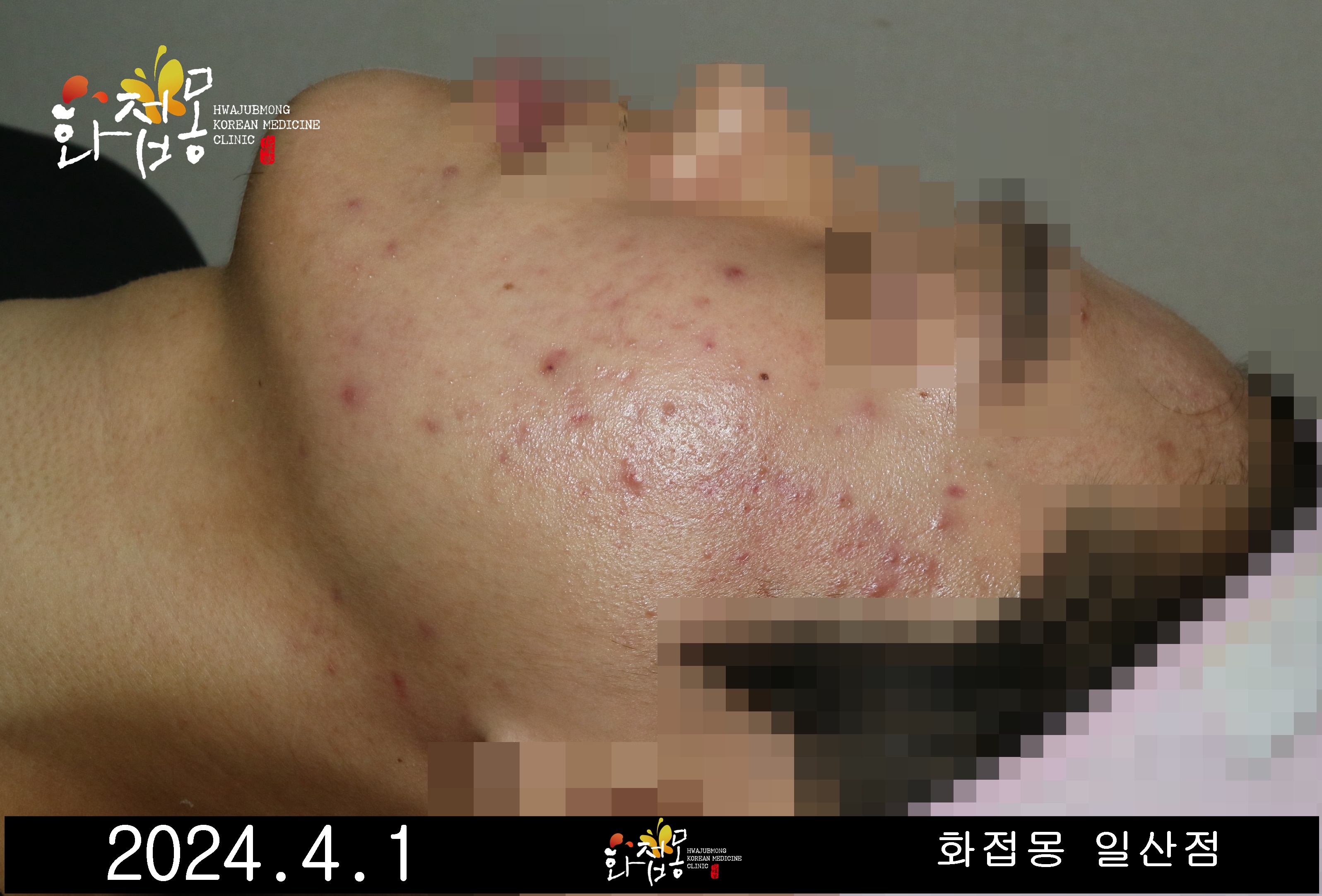 전후사진