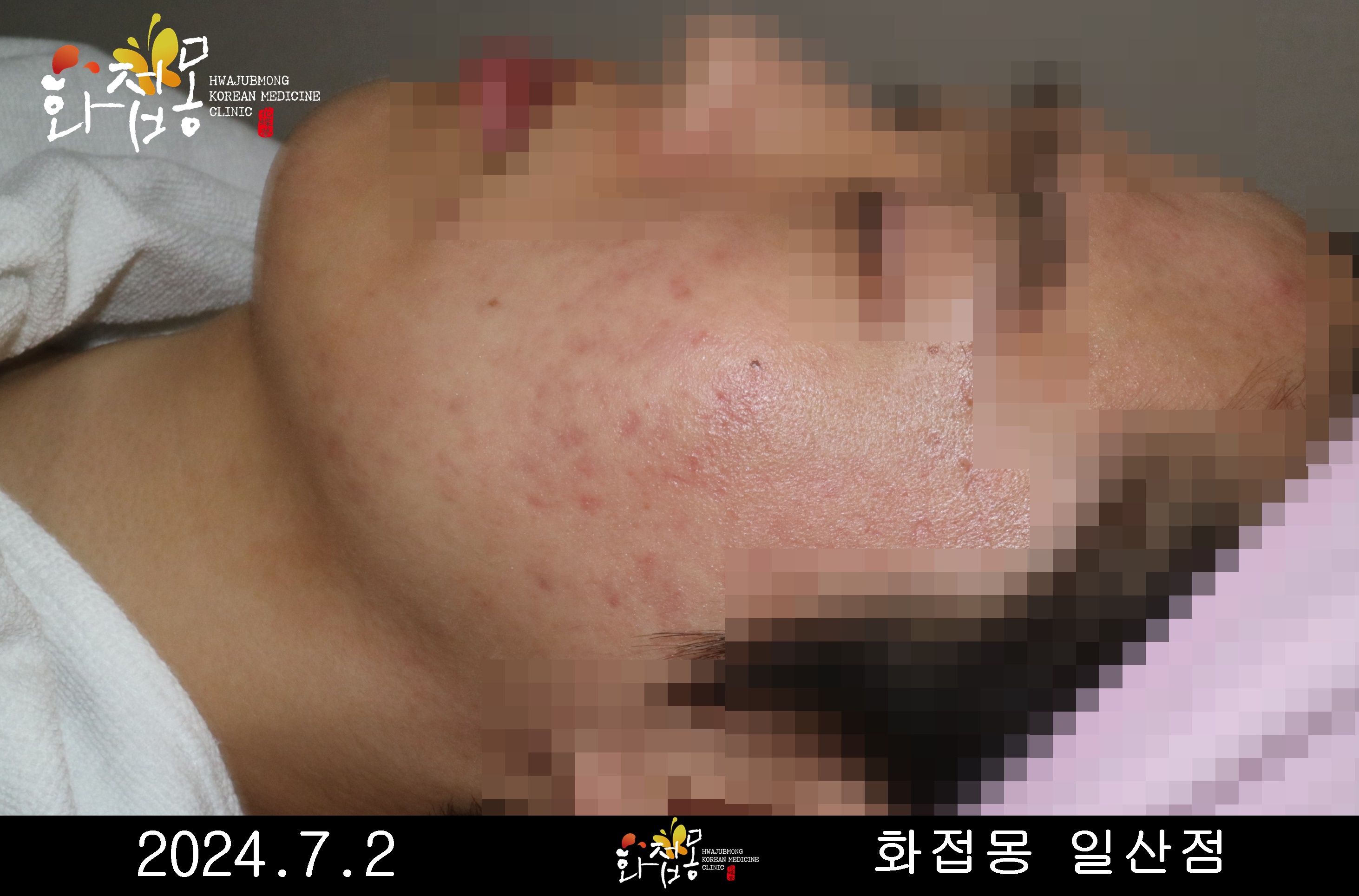 전후사진