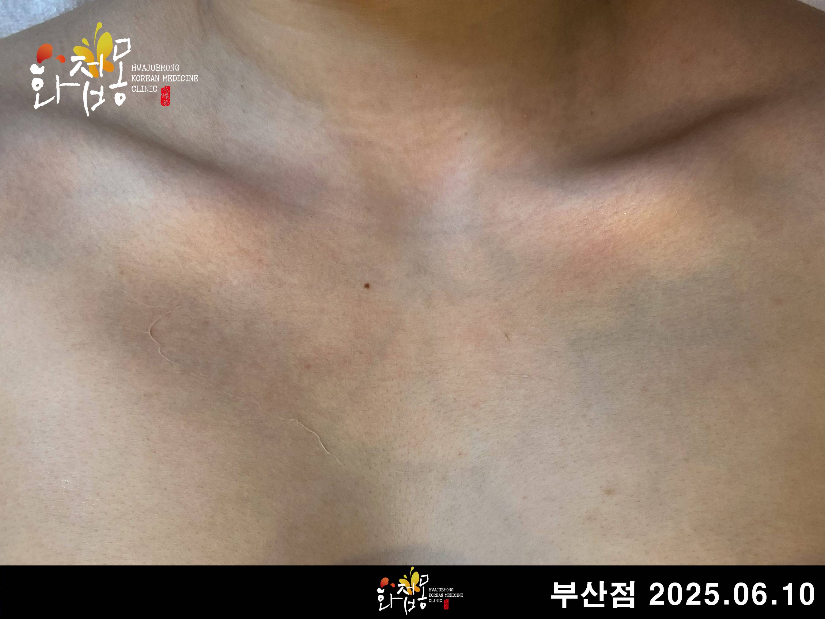 전후사진
