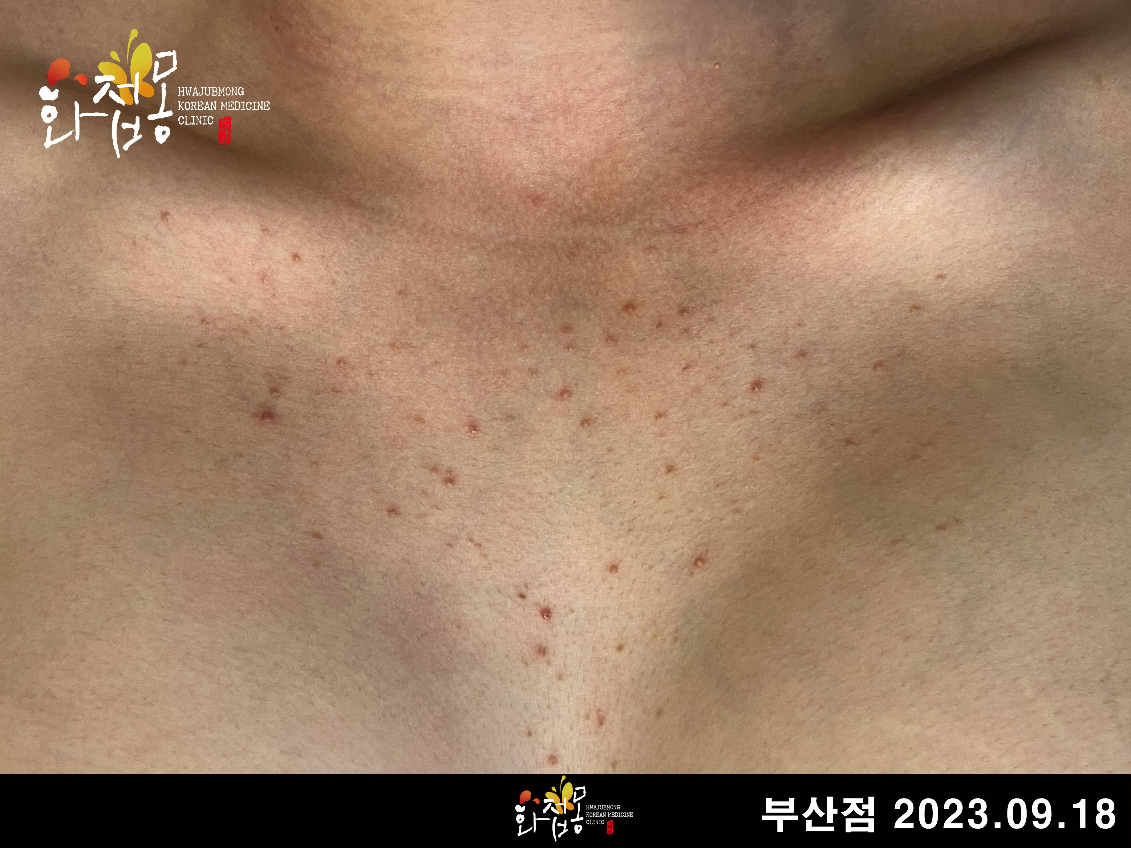 전후사진