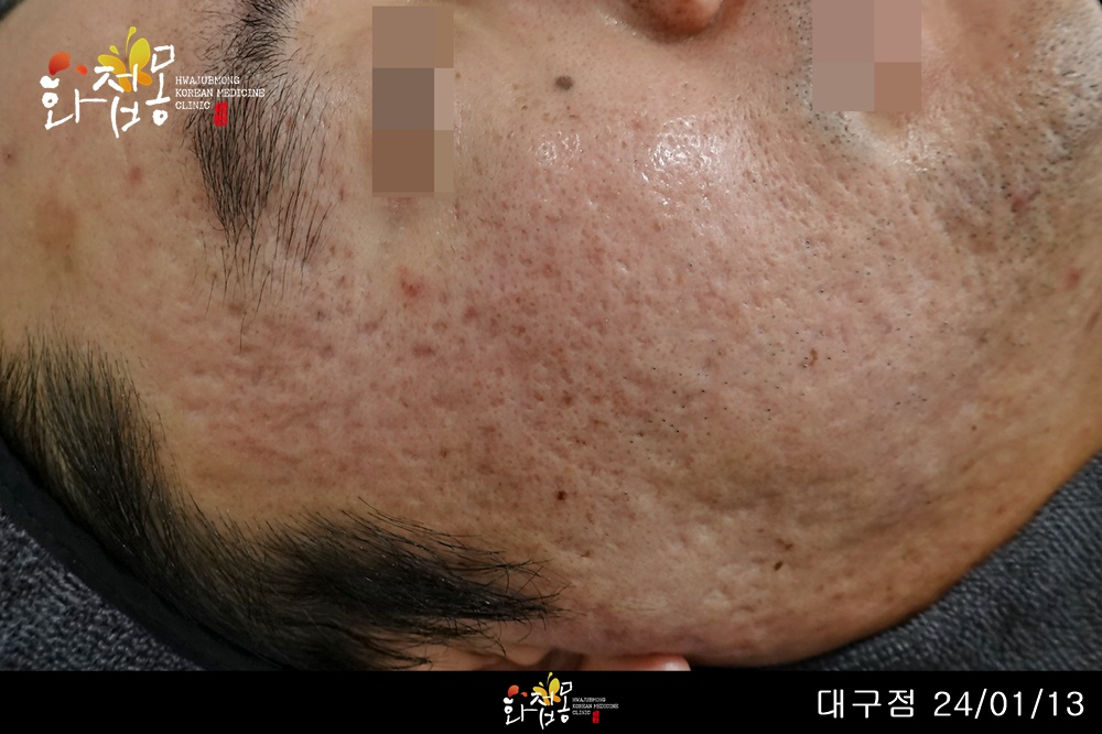 전후사진