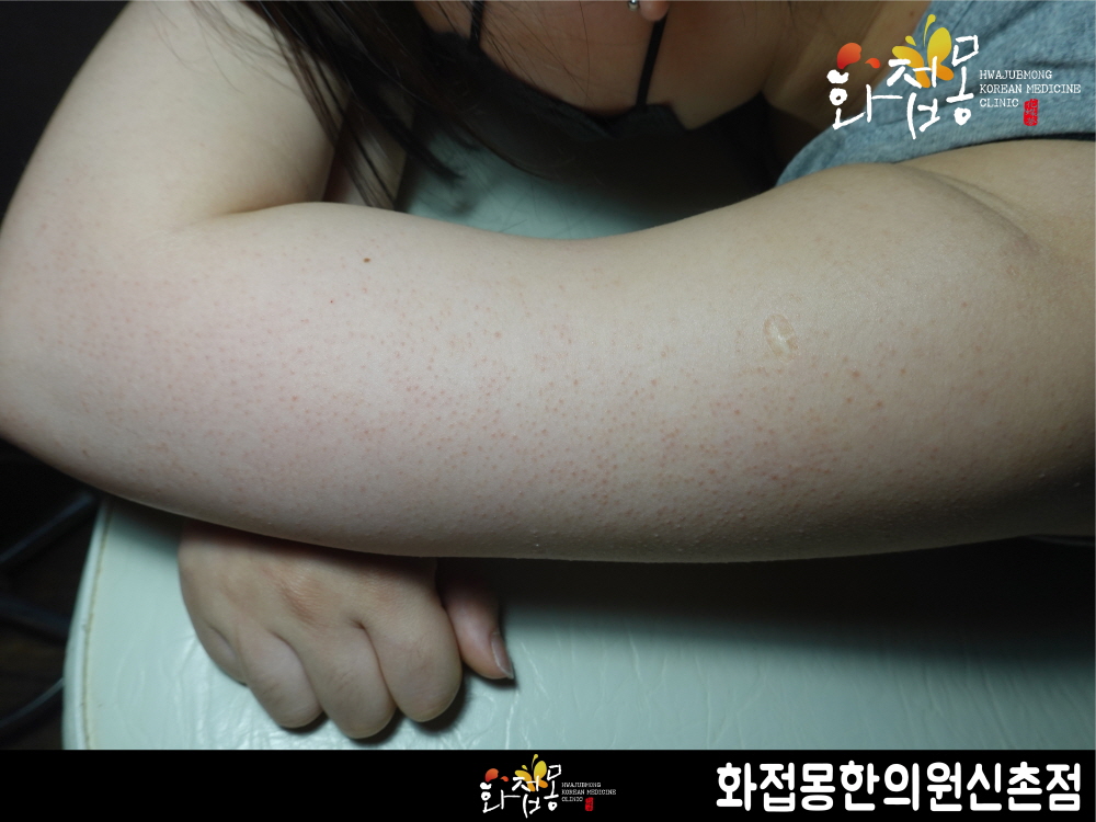 전후사진