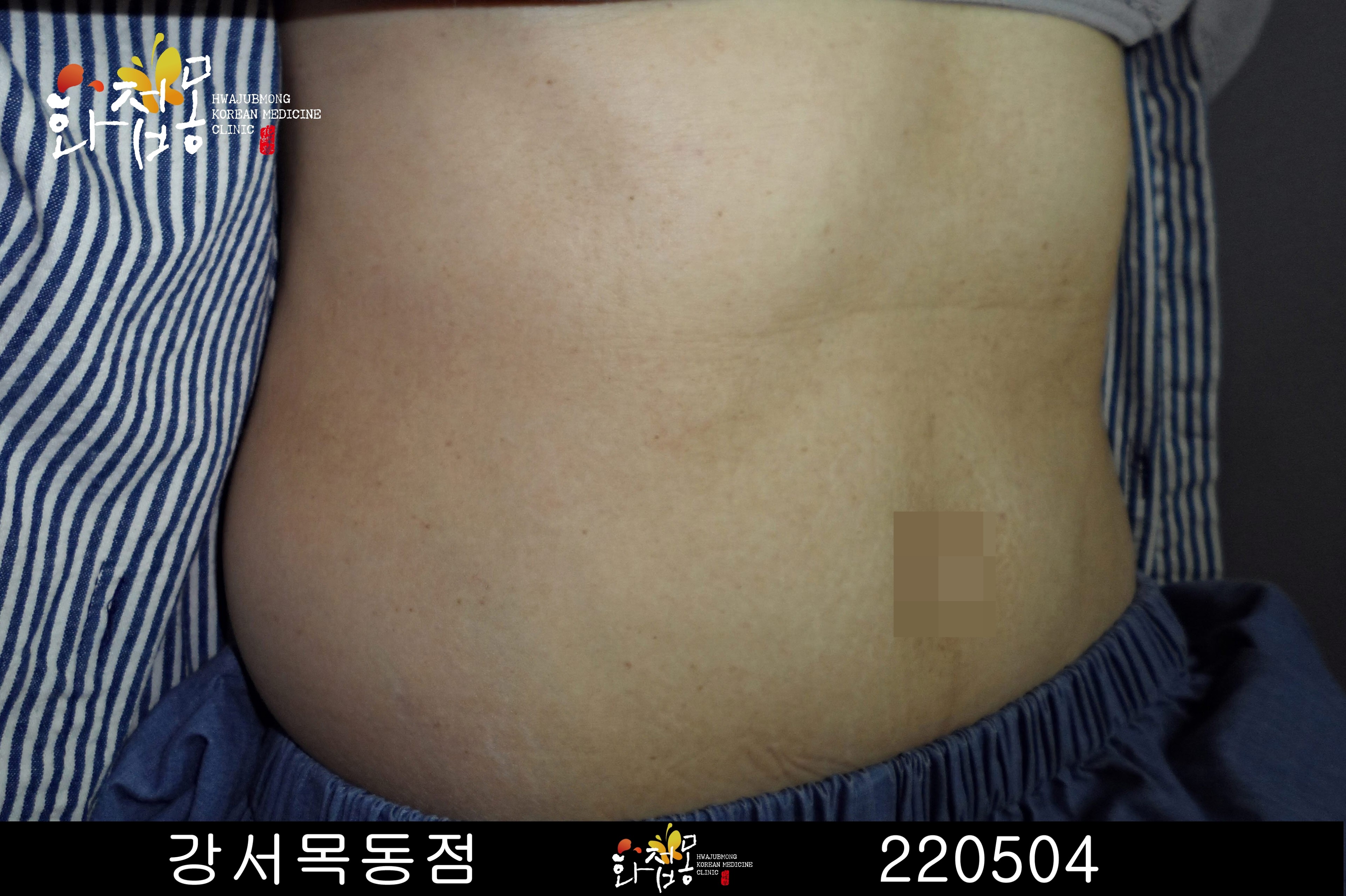 전후사진