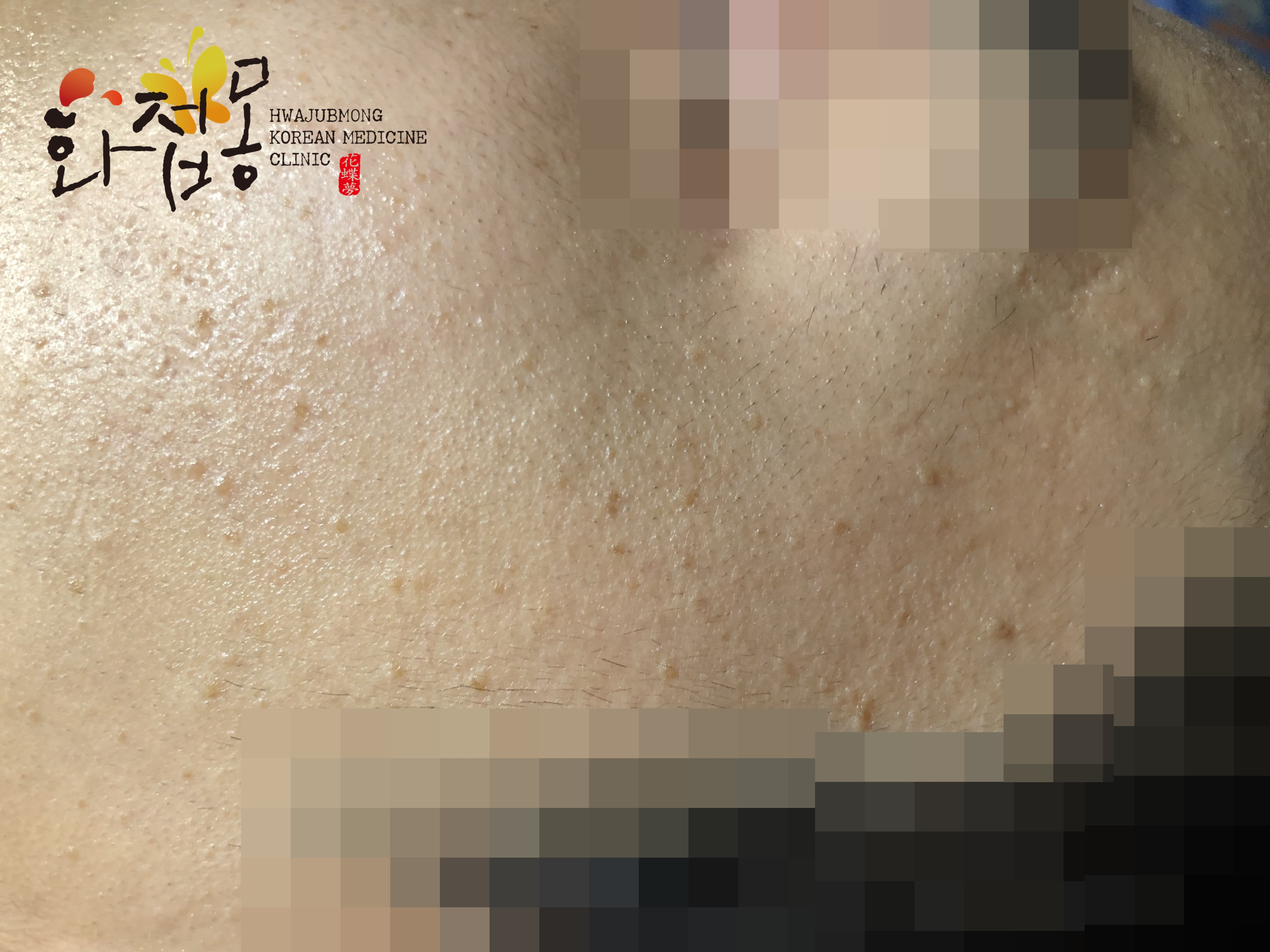 전후사진