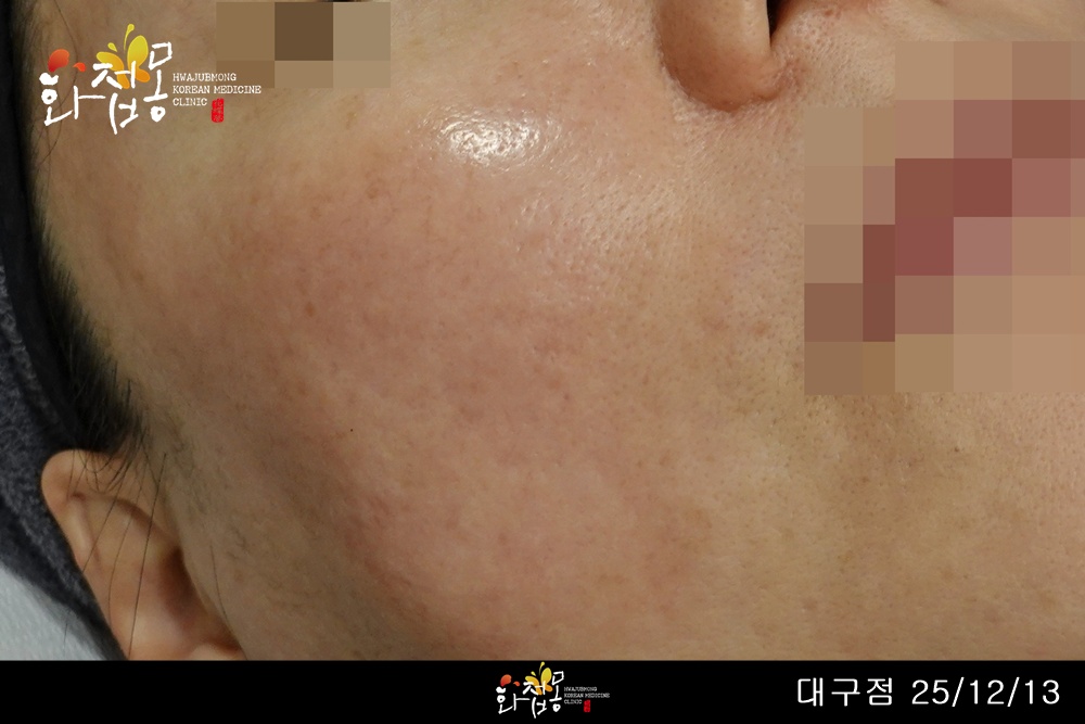 전후사진