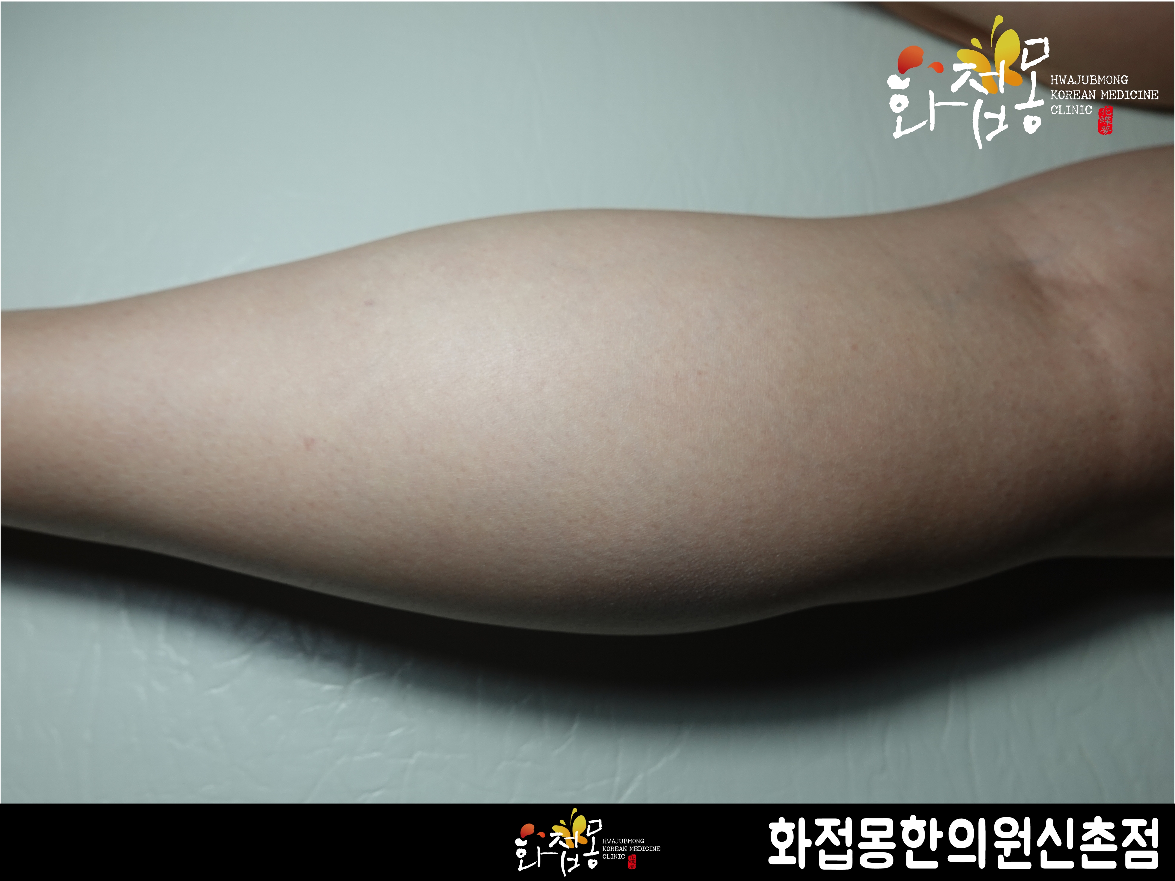 전후사진