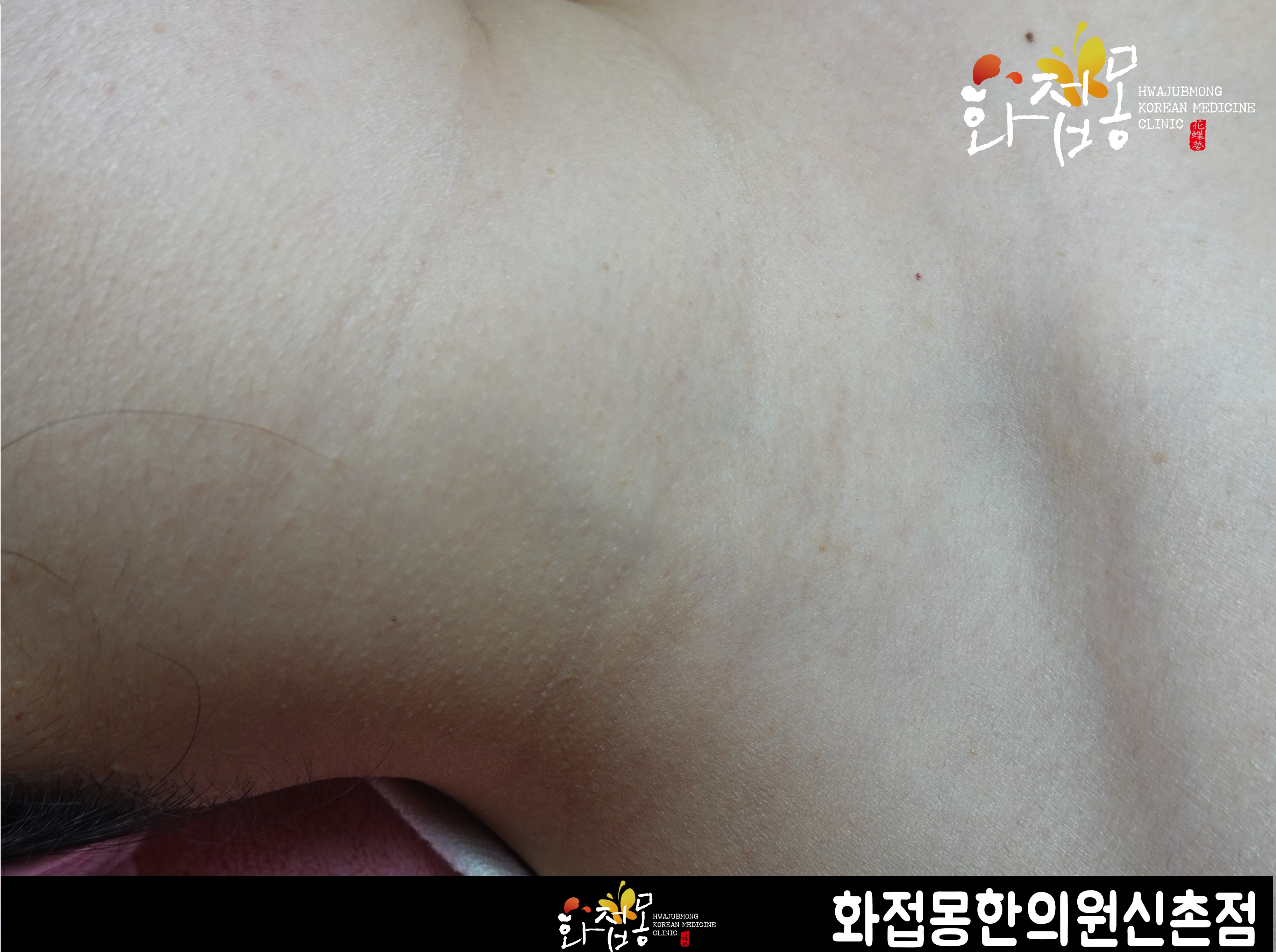 전후사진