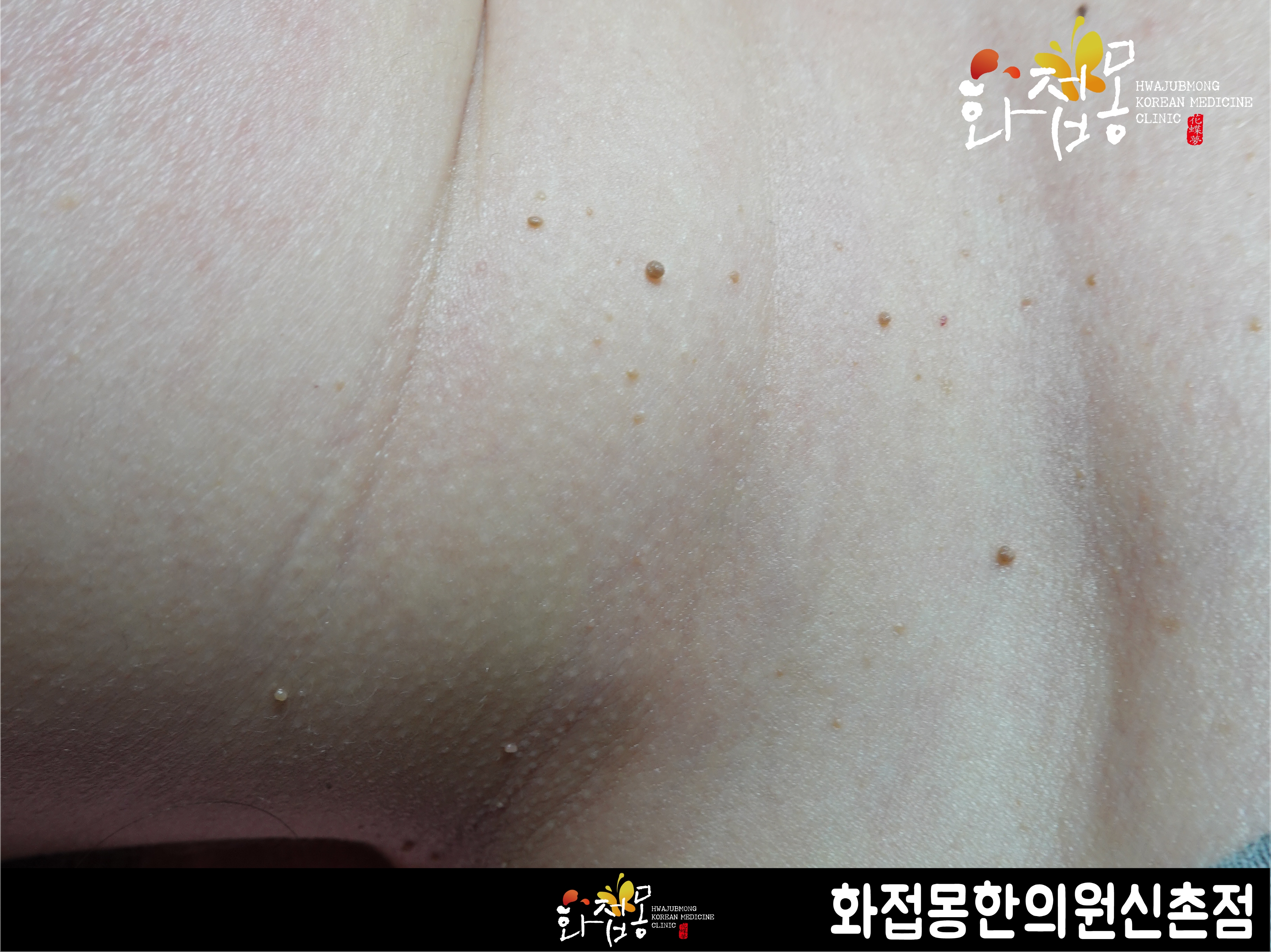 전후사진
