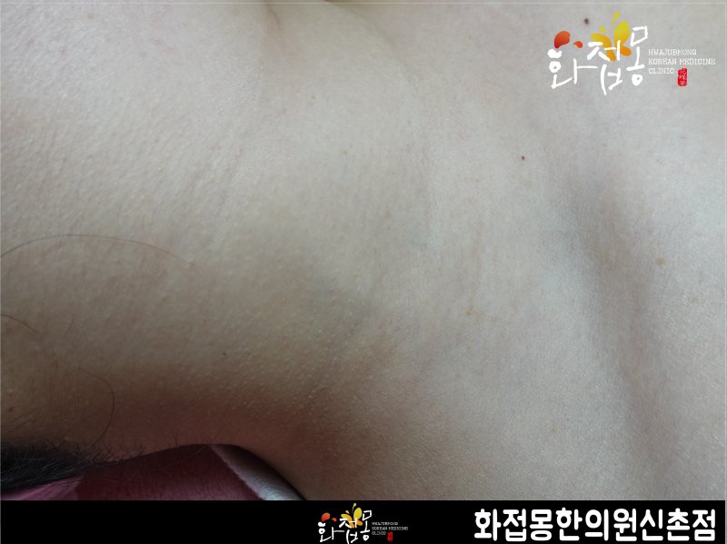 전후사진