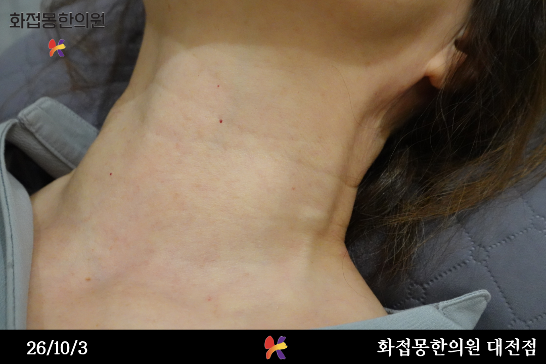 전후사진