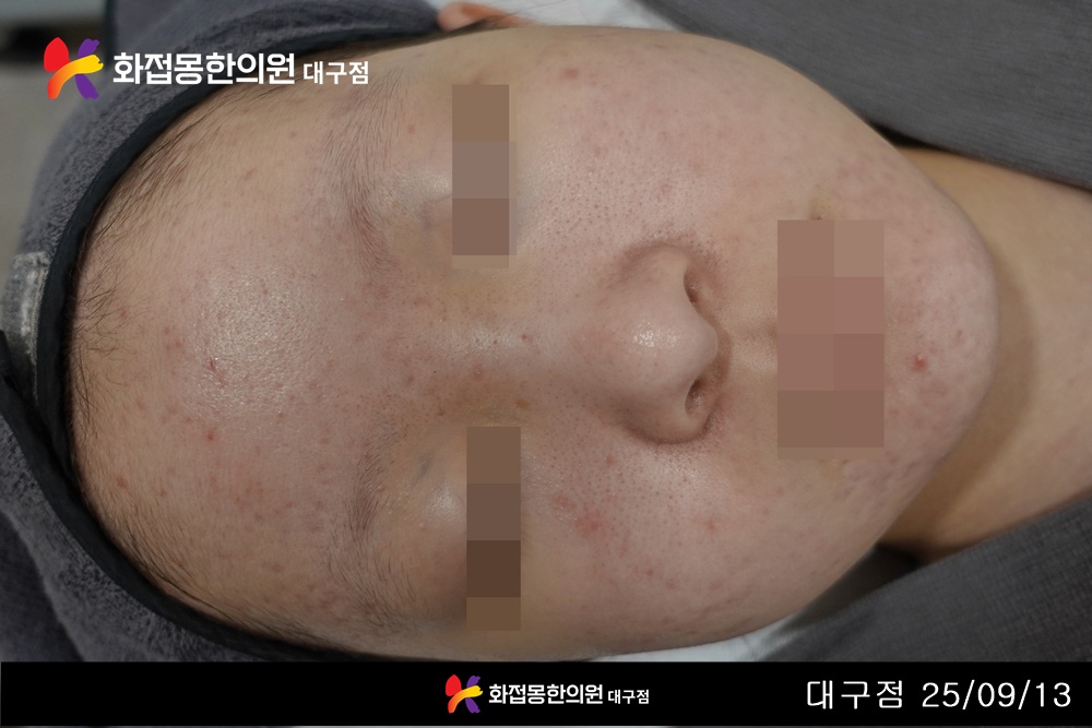 전후사진