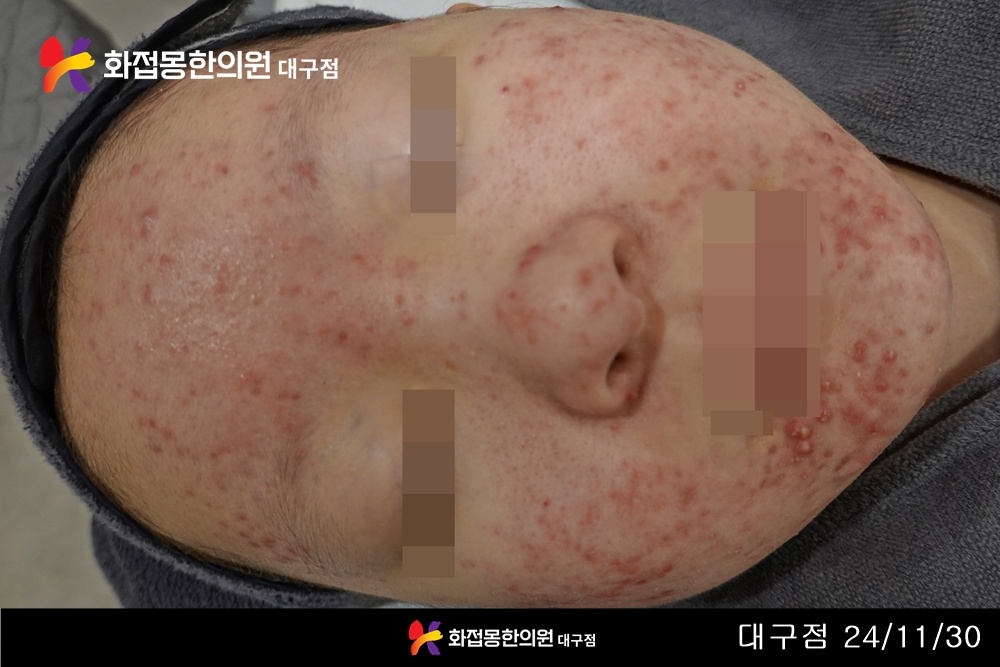 전후사진