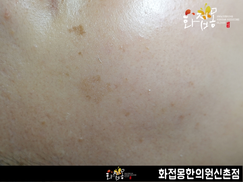 전후사진