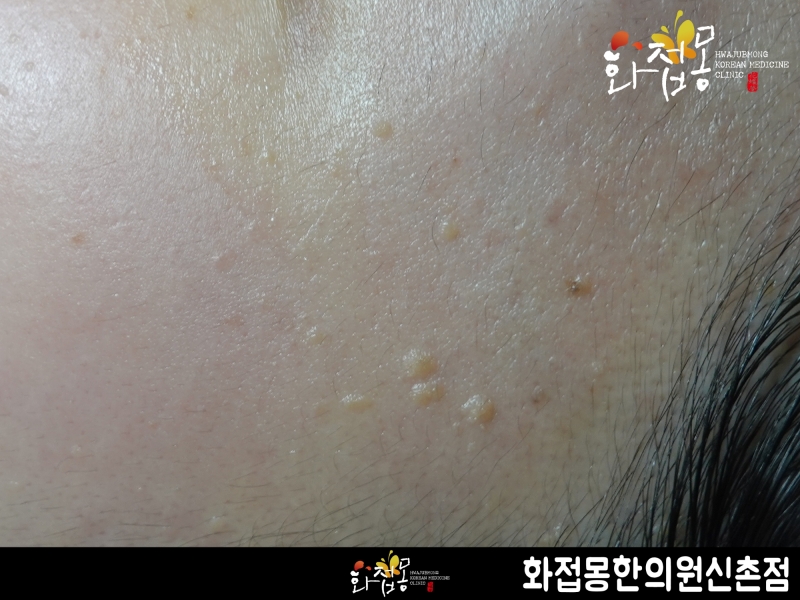 전후사진