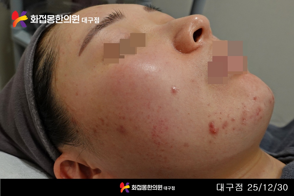 전후사진