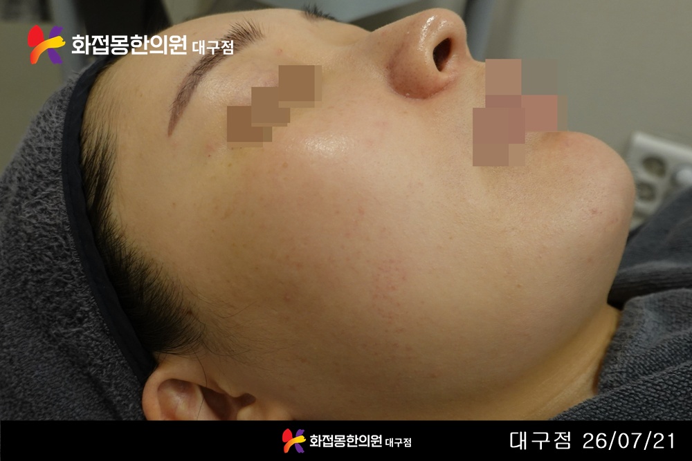 전후사진