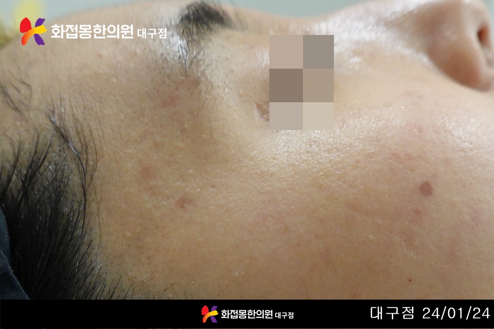 전후사진