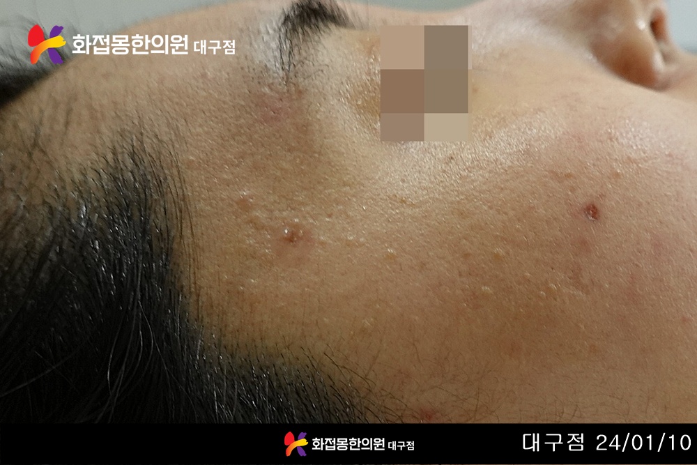 전후사진