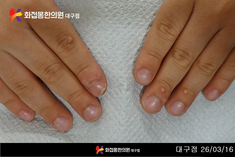 전후사진